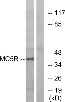 MC5-R antibody