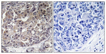 MDA5 antibody