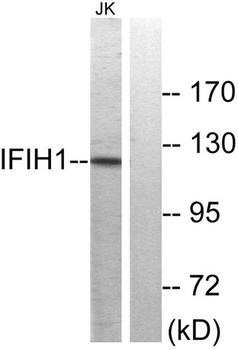 MDA5 antibody