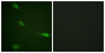 MDM2 antibody