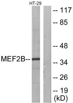 MEF-2B antibody