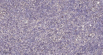 MEF-2B antibody