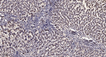 MEK Kinase-3 antibody