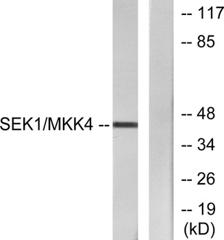 MEK-4 antibody