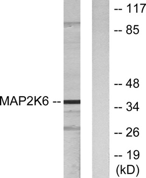 MEK-6 antibody