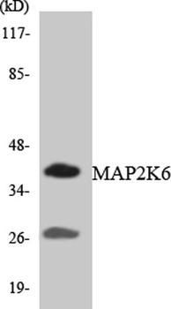 MEK-6 antibody