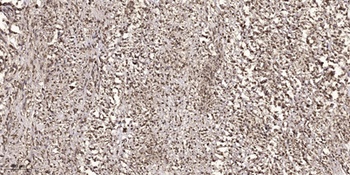 MEK-6 antibody