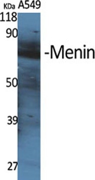 Menin rabbit pAb