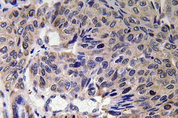 Mfn2 antibody