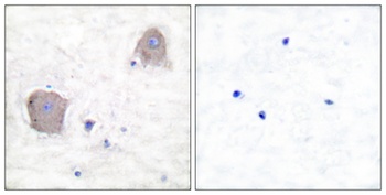 mGluR-4 antibody