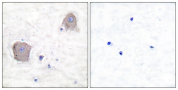 mGluR-4 rabbit pAb
