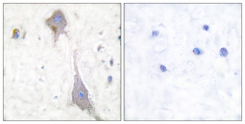 mGluR-7 rabbit pAb