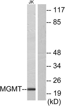 MGMT antibody