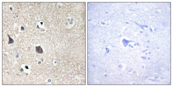 Midline-1 rabbit pAb