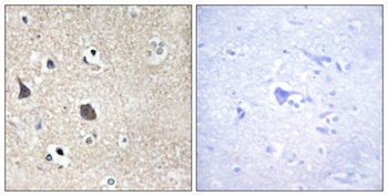 Midline-1 antibody