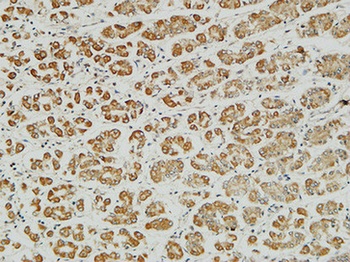 MITF antibody