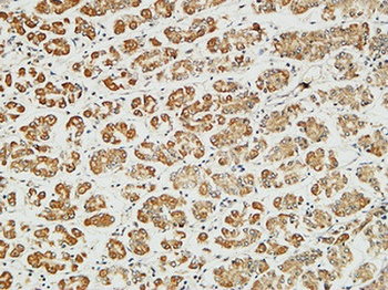 MITF antibody