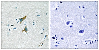 MKP-1 rabbit pAb