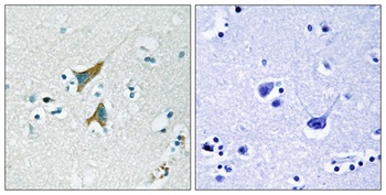 MKP-1 antibody