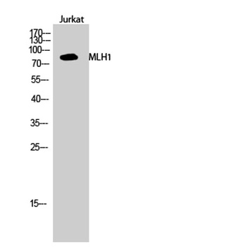 MLH1 rabbit pAb