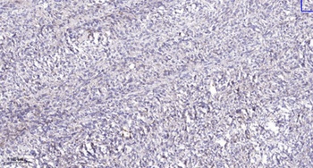 MLH1 antibody