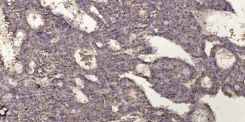 ML-IAP antibody