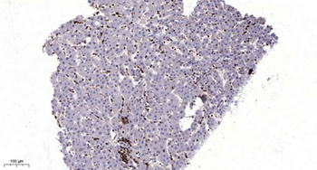 MLKL antibody