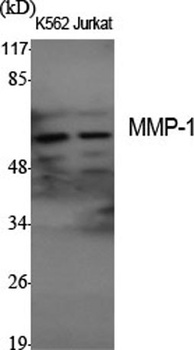 MMP-1 rabbit pAb