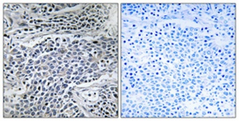 MMP-11 antibody