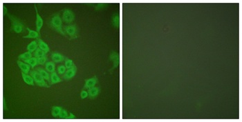 MMP-11 antibody