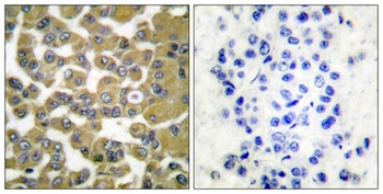 MMP-11 antibody