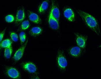 MMP-13 antibody