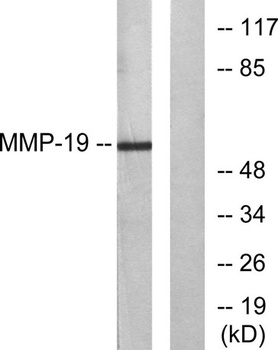 MMP-19 antibody