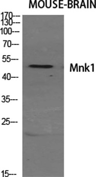 Mnk1 rabbit pAb Antibody