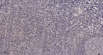 Mnk1 antibody