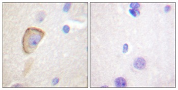 MOR-1 rabbit pAb