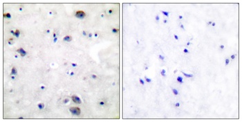 MOR-1 antibody