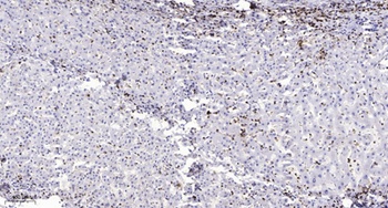 MPP9 rabbit pAb