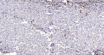 MPP9 antibody