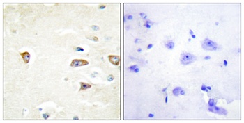 MRCK beta antibody