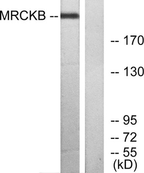 MRCK beta antibody