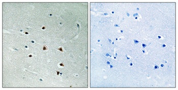 MRE11 antibody