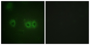 MRLC2 rabbit pAb