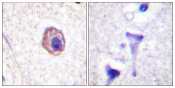 MRLC2 rabbit pAb