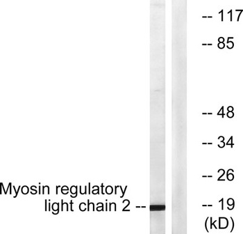MRLC2 antibody