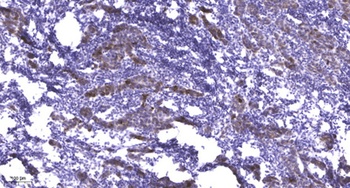 MRP3 antibody