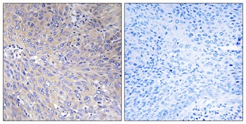 MRP-L11 rabbit pAb