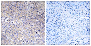 MRP-L11 antibody