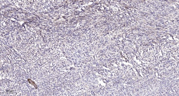 MRP-L12 antibody