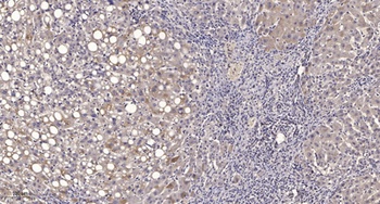 MRP-L14 antibody